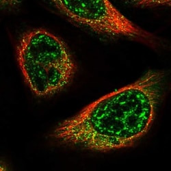 CCDC32 Antibody, Novus Biologicals 25 &mu;L | Buy Online | Novus Biologicals | Fisher Scientific